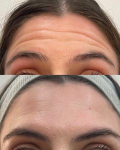 Lineas de Expresión