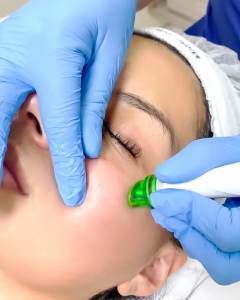 Limpieza facial profunca con aparatologia